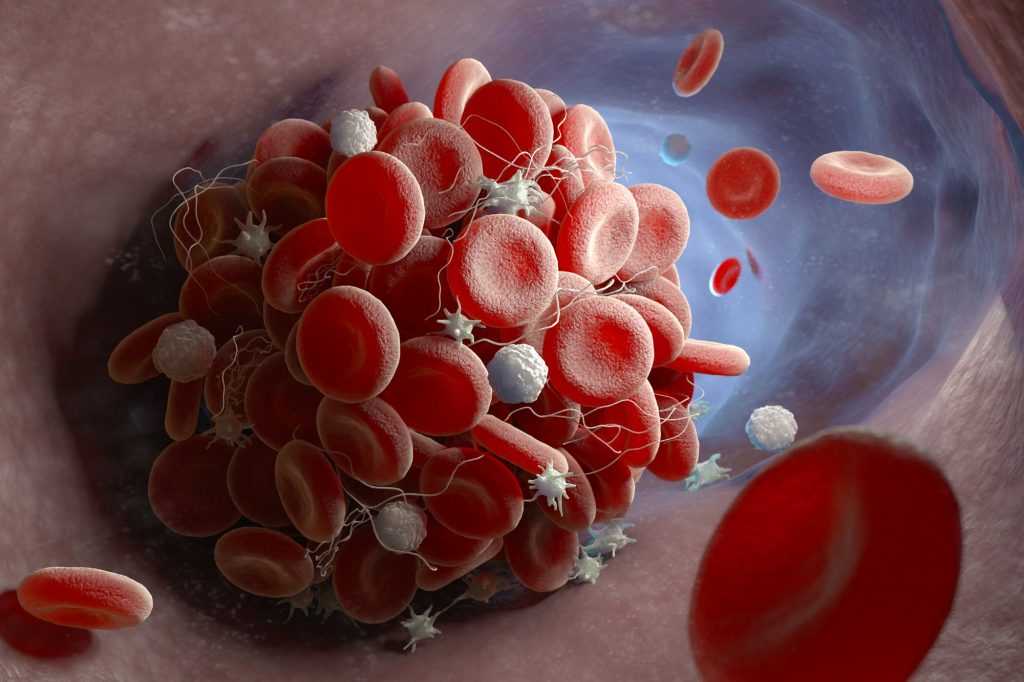 Formation of a blood clot