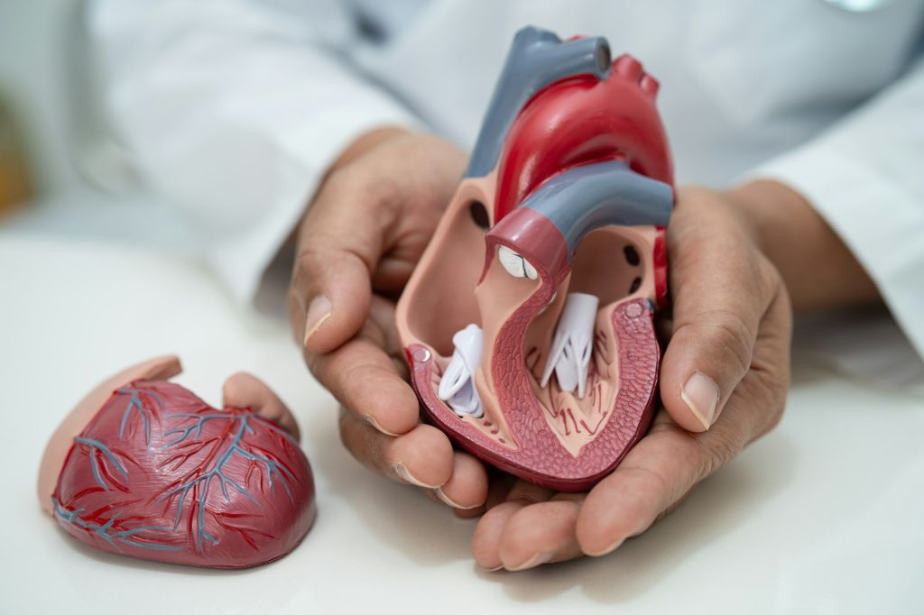 Cardiovascular disease CVD, Asian doctor holding human anatomy model for learn and treat heart