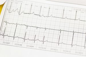 Diagnosis kegagalan jantung