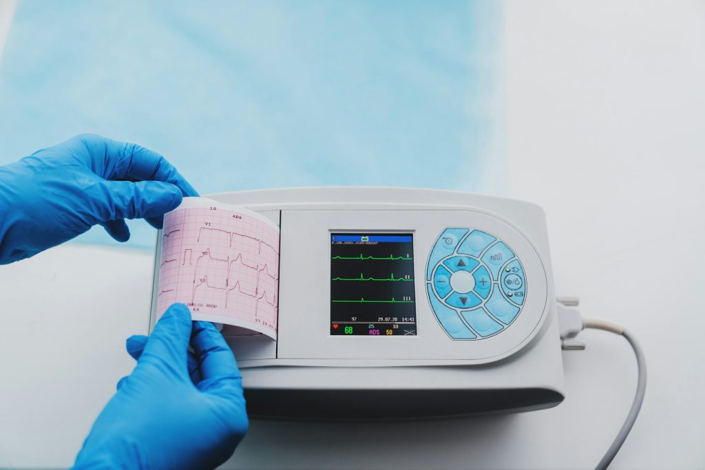 Close up view of ECG machine display and print out trip chart indicating pulse tare