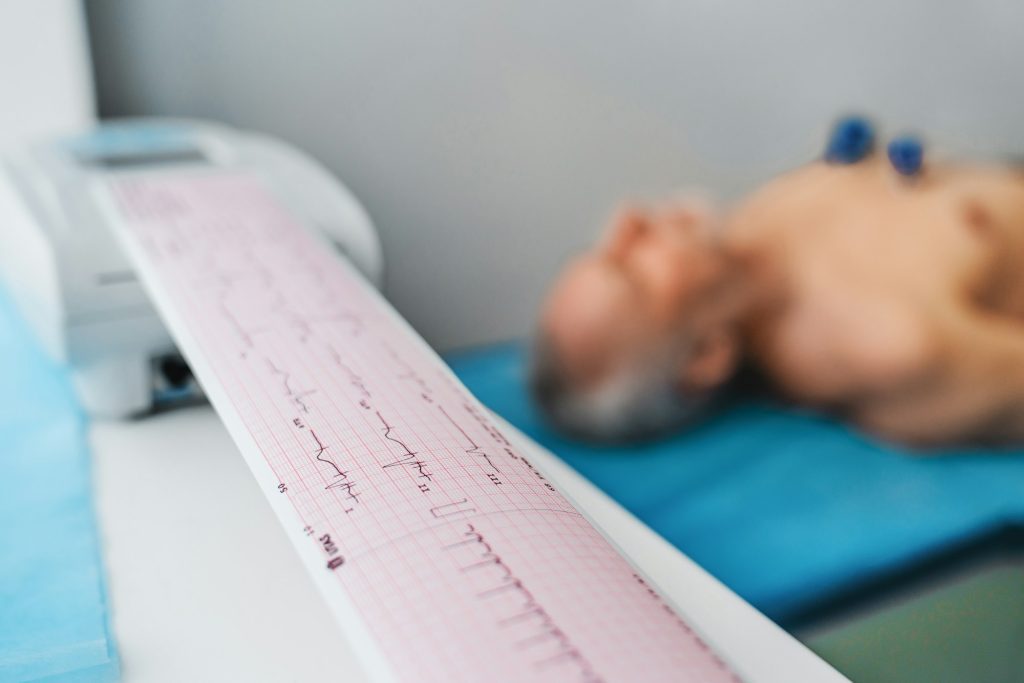 ECG. Cardiogram printout on male patient background