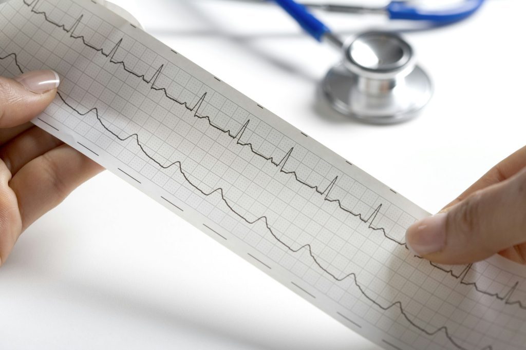 Hands Holding A Regular Ecg With A Stethoscope