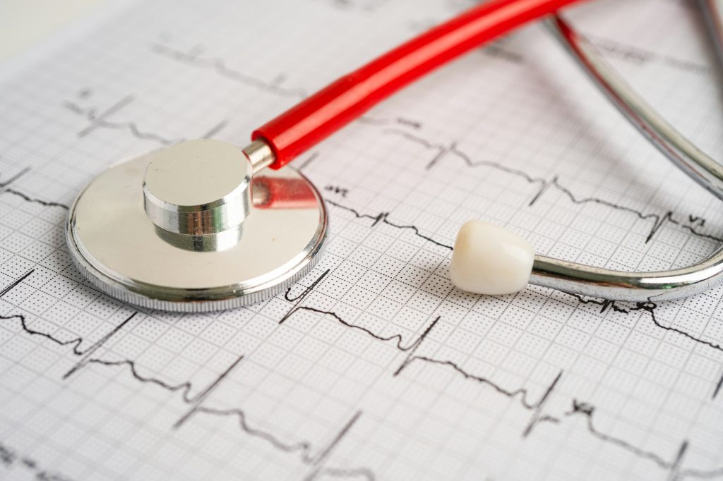 Stethoscope on electrocardiogram ECG, heart wave, heart attack, cardiogram report.